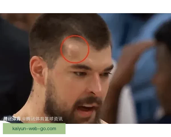 祖巴茨回应被打肿头不犯规称裁判判定克林根空接下次也要抡肘子